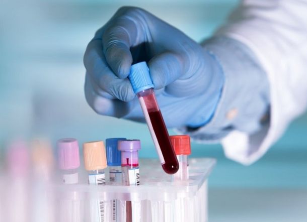 Ternyata Golongan Darah ini Lebih Rentan Terkena Virus Corona