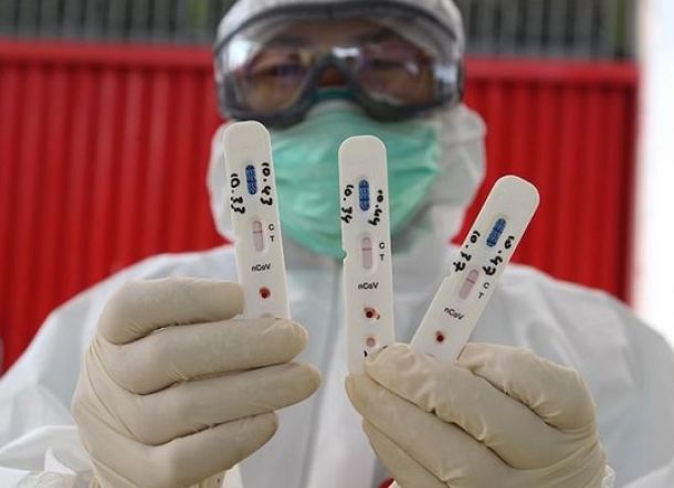 Parah! Oknum Perawat dan Staf RS Ditangkap karena Palsukan Hasil Tes Covid-19