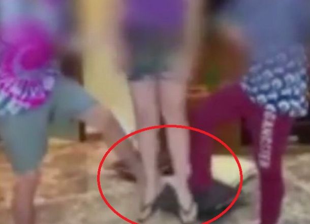 Anak 13 Tahun Geger Otak Gegara Bikin Video 'Challenge' untuk TikTok