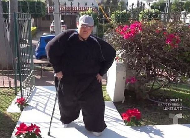 Luar Biasa! Pria Paling Gemuk di Dunia Berhasil Turunkan 330 Kg Dalam 3 Tahun