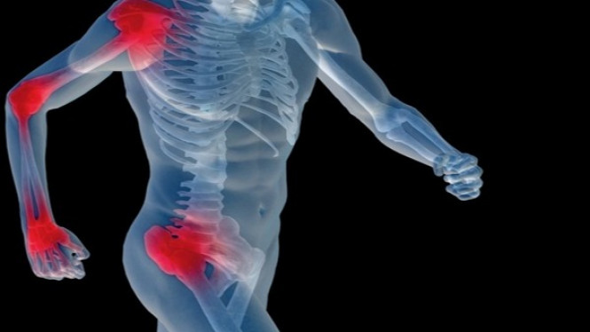 4 Makanan yang Membantu Mencegah Nyeri Sendi