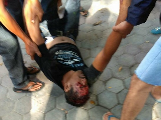 Warga Tangkerang Pekanbaru Digegerkan Penemuan Korban Pingsan Dengan Luka Robek Dikepala