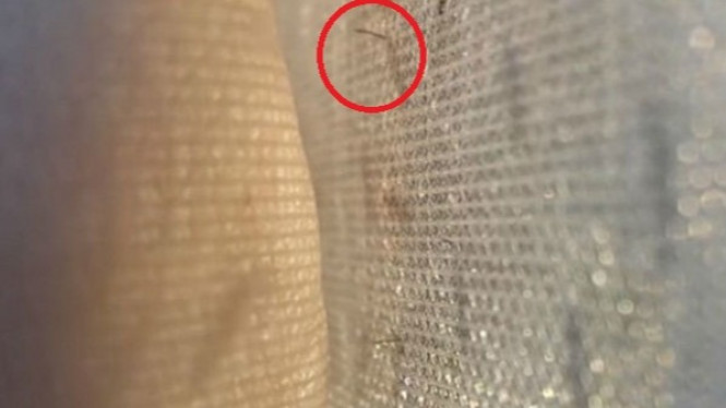 Mengerikan, Video Nyamuk Berusaha Menjangkau Kulit Manusia