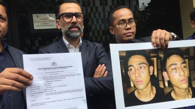 Polisi: Axel Mathew Anak Jeremy Thomas Akui Beli Narkoba Jenis H5
