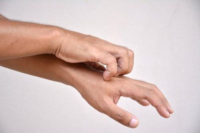 Kasus Cacar Monyet Didominasi Orang Dewasa, Begini Cara Mencegahnya