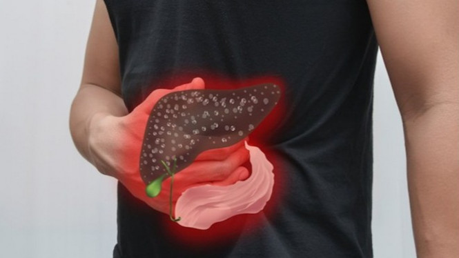 Sarang Semut, Cara Baru Sembuhkan Kanker Hati Secara Alami