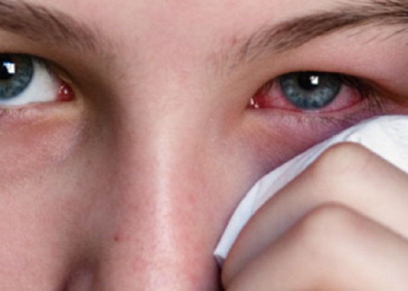 Empat Dampak Buruk Merokok pada Mata, Apa Saja?