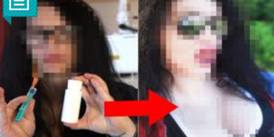 Suntik wajah menggunakan bakteri berusia 3,5 tahun, wajah artis cantik ini malah jadi begini!