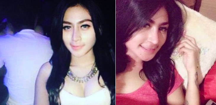 Beredar Foto-foto Hot Tiara Fauziah, Model Seksi Penabrak Ojol Hingga Kaki Putus