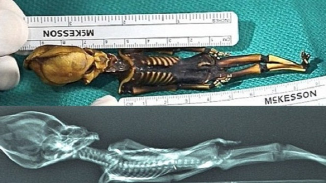 Mumi 'Alien' Atacama 15 Cm dengan Kepala Kerucut Itu Manusia