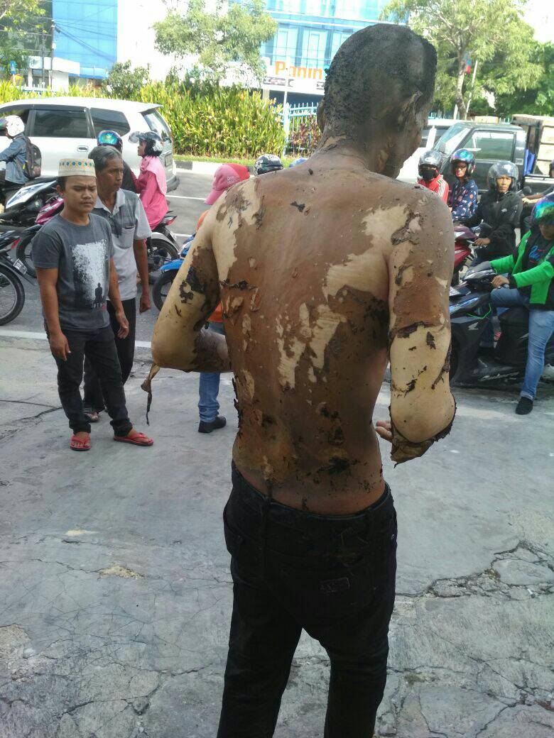 Heboh, Pria di Pekanbaru Dibakar Orang Tak Dikenal