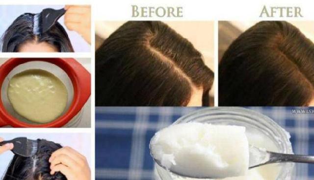 Tebalkan Rambut Tipis dalam Semalam dengan Tiga Bahan Ini