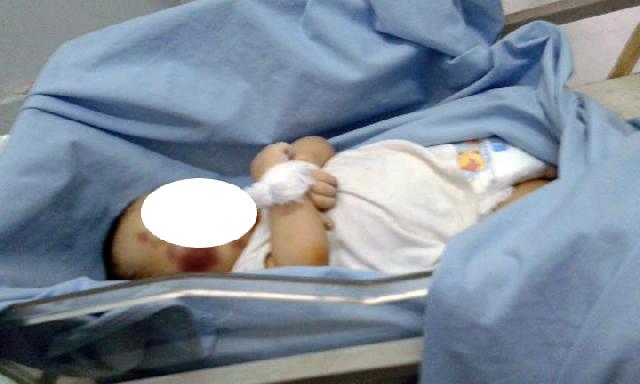 Tragis, Balita Usia 18 Bulan Meregang Nyawa Diduga Dianiaya