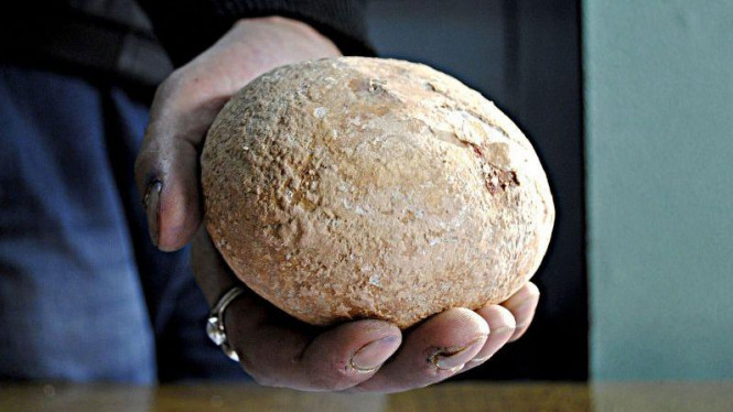 Sering Menahan Kencing Picu Munculnya Batu Ginjal