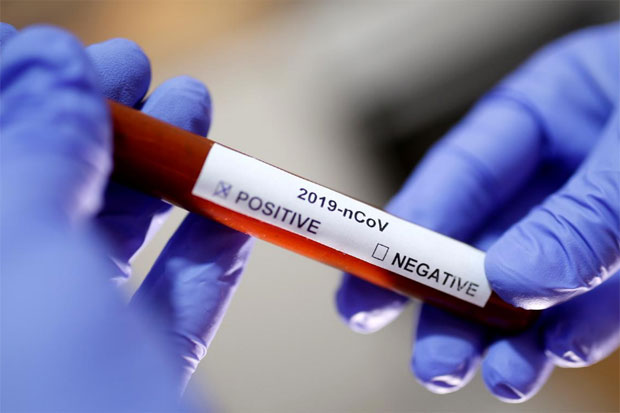 Rektor Universitas Sumatera Utara dan Wakil Positif COVID-19