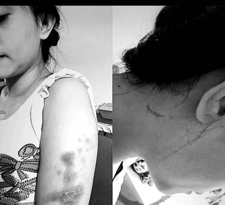 Ngaku Dianiaya Seorang Oknum Polwan, Unggahan Wanita ini Viral di Medsos