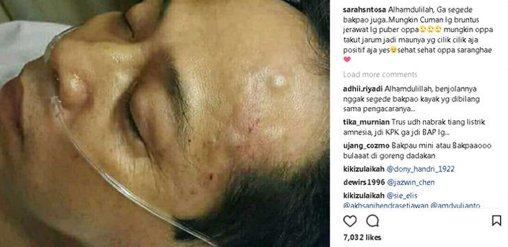 Kuasa hukum Sebut Setya Novanto Muntah-muntah dan Tak Stabil, Anda Percaya?