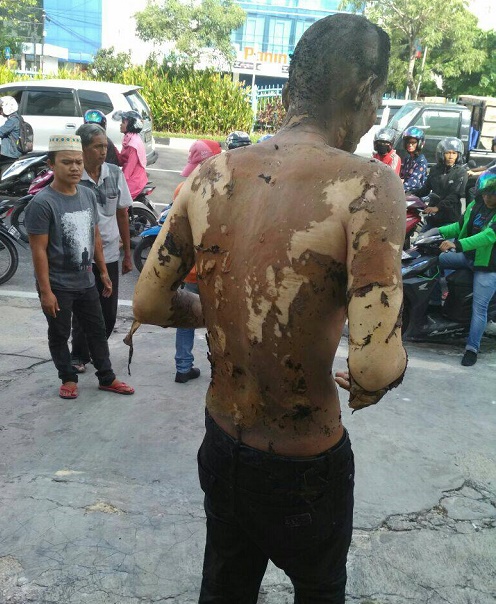 Diduga Karena Urusan Hutang Pihutang, Edrian Warga Pekanbaru ini Dibakar