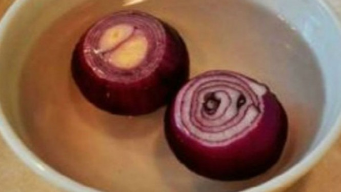 Tambahkan Ini dengan Bawang, Ginjal Bersih Sepenuhnya