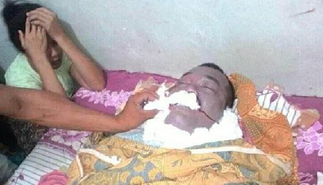 Tertelan Ikan Hidup, Karyawan PT Adei Pangkalan Kuras Pelalawan Meninggal