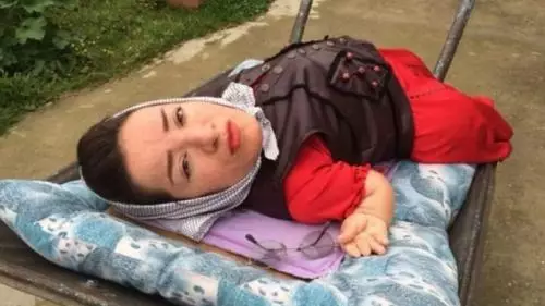 Perempuan Difabel Juga Perlu Cinta dan Punya Hasrat Seksual