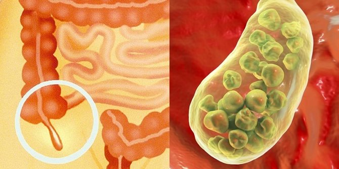 Organ Paling 'Tak Berguna' Dalam Tubuh