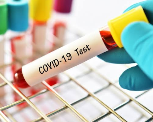 Kasus Covid-19 di Pekanbaru Didominasi Usia Produktif