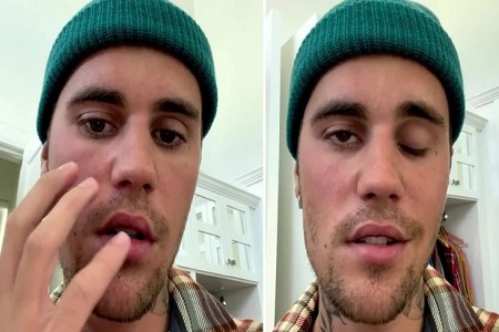 Ini Cara Cegah Sakit Sindrom Ramsay Hunt yang Dialami Justin Bieber