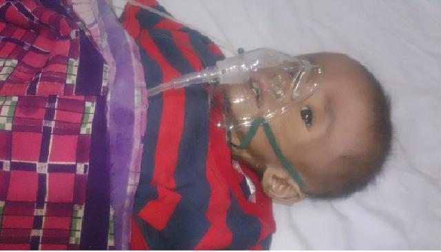 Balita Penderita Gizi Buruk di Inhu Meninggal Dunia