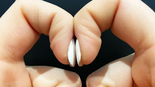 Viral Tes Gabungkan Dua Jari Bisa Lihat Risiko Kanker Paru-paru