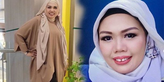 Perubahan Wajah Elly Sugigi Dari Potong Gigi hingga Kencangkan Kulit, Berubah Drastistis Sampai Sulit Dikenali