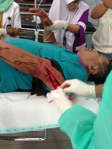 Warga Tenayan Raya Pekanbaru Luka Parah Dibacok Pria Misterius