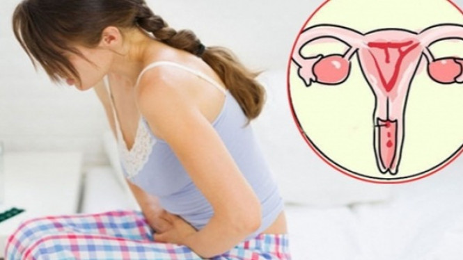 Empat Kebiasaan Buruk Ini Picu Kanker Serviks