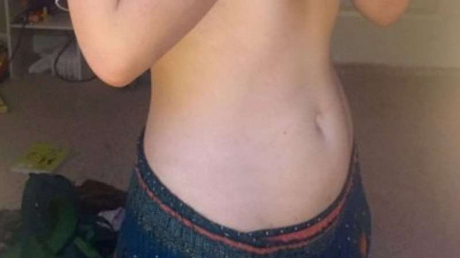 Asam Urat Bisa Dihilangkan dengan Mengoleskan Minyak di Pusar