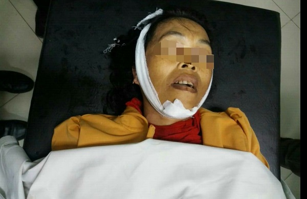 Sempat Diduga Korban Pembunuhan, Ternyata Ani Tewas Karena Stroke