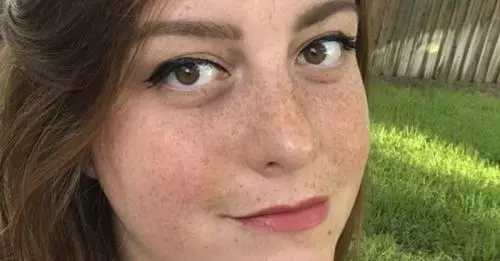 Hii.. Kecoa Bersarang 9 Hari di Telinga Perempuan Ini, Kok Bisa?