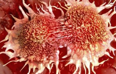 Daya Tahan Penderita Kanker Bisa Ditingkatkan Hanya dengan Vitamin D