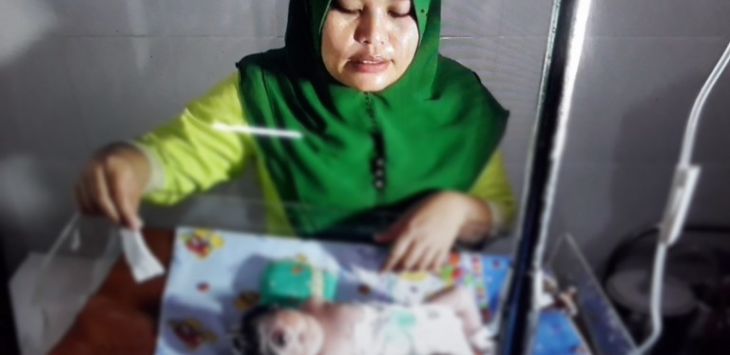 Ini Dugaan Penyebab Bayi Perempuan Lahir Bermata Satu di Sumatera Utara