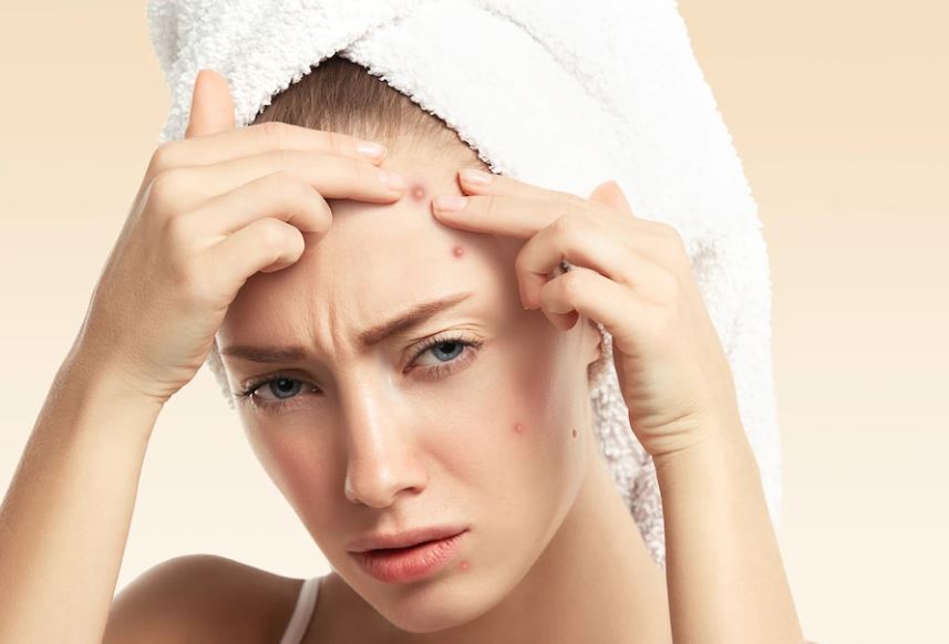 5 Kesalahan Pola Tidur yang Memicu Jerawat