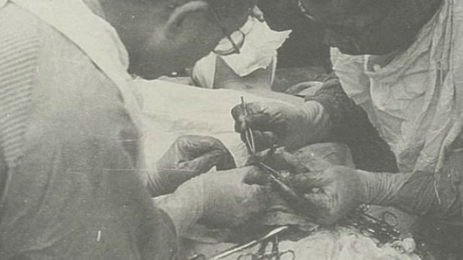 Terkuak, Jepang Buat Unit Percobaan Manusia di Perang Dunia II