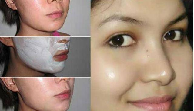 Ini Cara Hilangkan Bintik Pada Wajah Secara Alami Dalam 3 Malam