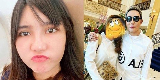 Perubahan Wajah Terkini Via Vallen Kembali Mengejutkan Warganet