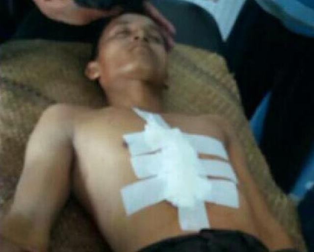 Penganiayaan Sadis di Rokan Hulu, Istri Tewas dan Suami Kritis