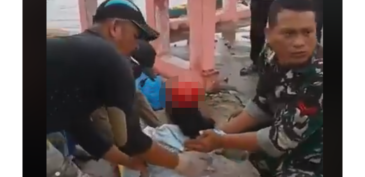 Astafirullah, Kulit Kepala Wanita Ini Terkelupas setelah Rambutnya Tersangkut Mesin Perahu