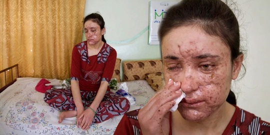 Pilunya Kisah Budak Seks ISIS, Ditahan Berhari-hari di Ruang Bawah Tanah Hingga Memakan Bayinya