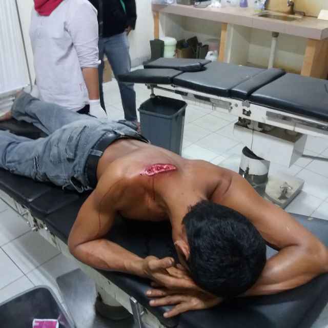 Tembak Penjaga Ternak, Dua Pelaku Pencuri Bersenpi di Kuansing, Juga Kena Bacok