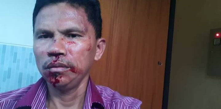 Posting Meme Hina Habib Rizieq-Amien Rais, Anggota DPRD Ini Keroyok Massa Sampai Babak Belur