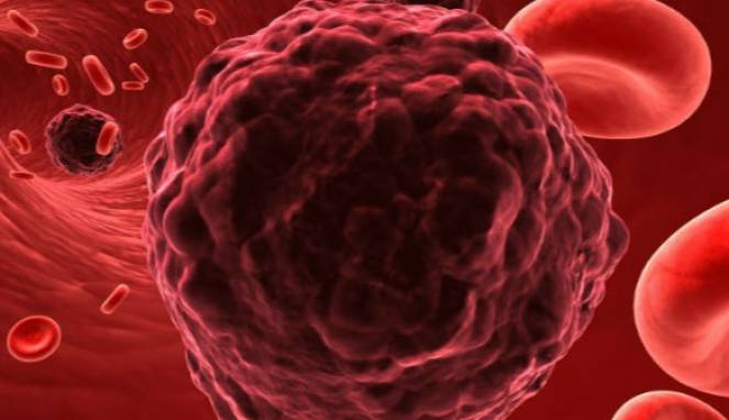 Awas, Kebiasaan yang Sering Anda Lakukan Ini Sebabkan Kanker