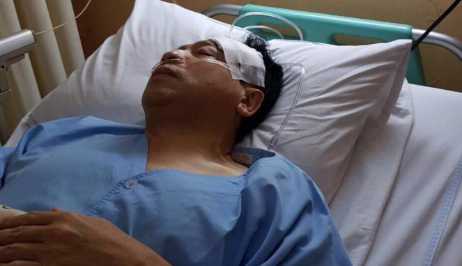 Setya Novanto Benjol Gara-gara Peraturan Pemerintah