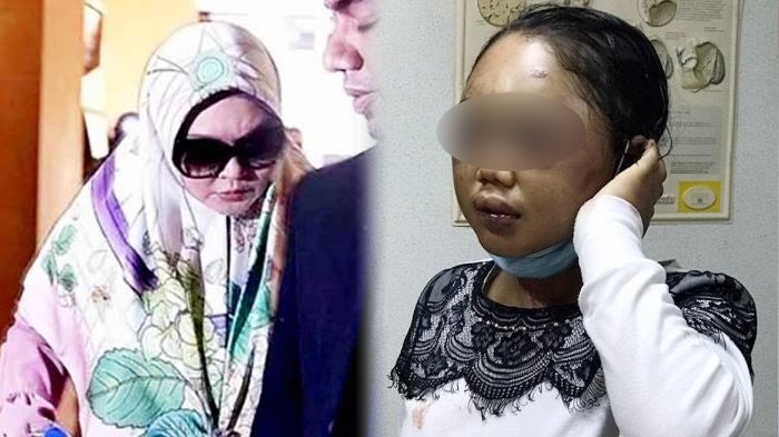 Viral, Siksa TKW Indonesia Sampai Kondisinya Parah, Majikan Asal Malaysia Lolos dari Hukuman, Kejam!